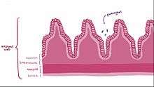 Video explaining Crohn disease.