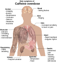 Torso of a young man with overlaid text of main side-effects of caffeine overdose.